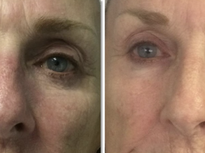 Screenshot 2025-03-04 at 4.36.52 PM